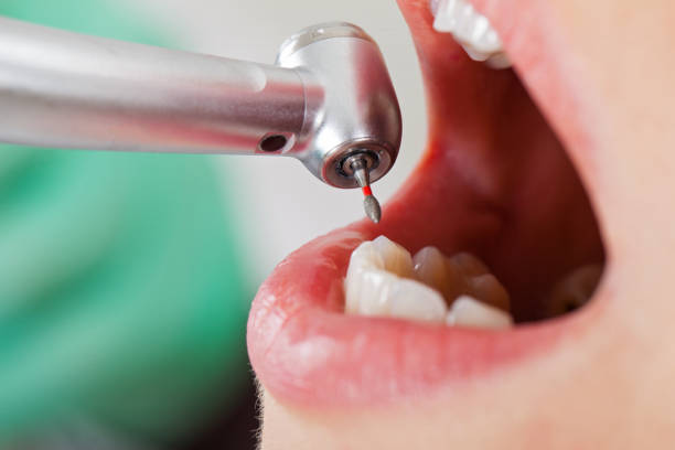 Best Urgent Tooth Repair  in Rapid City, MI